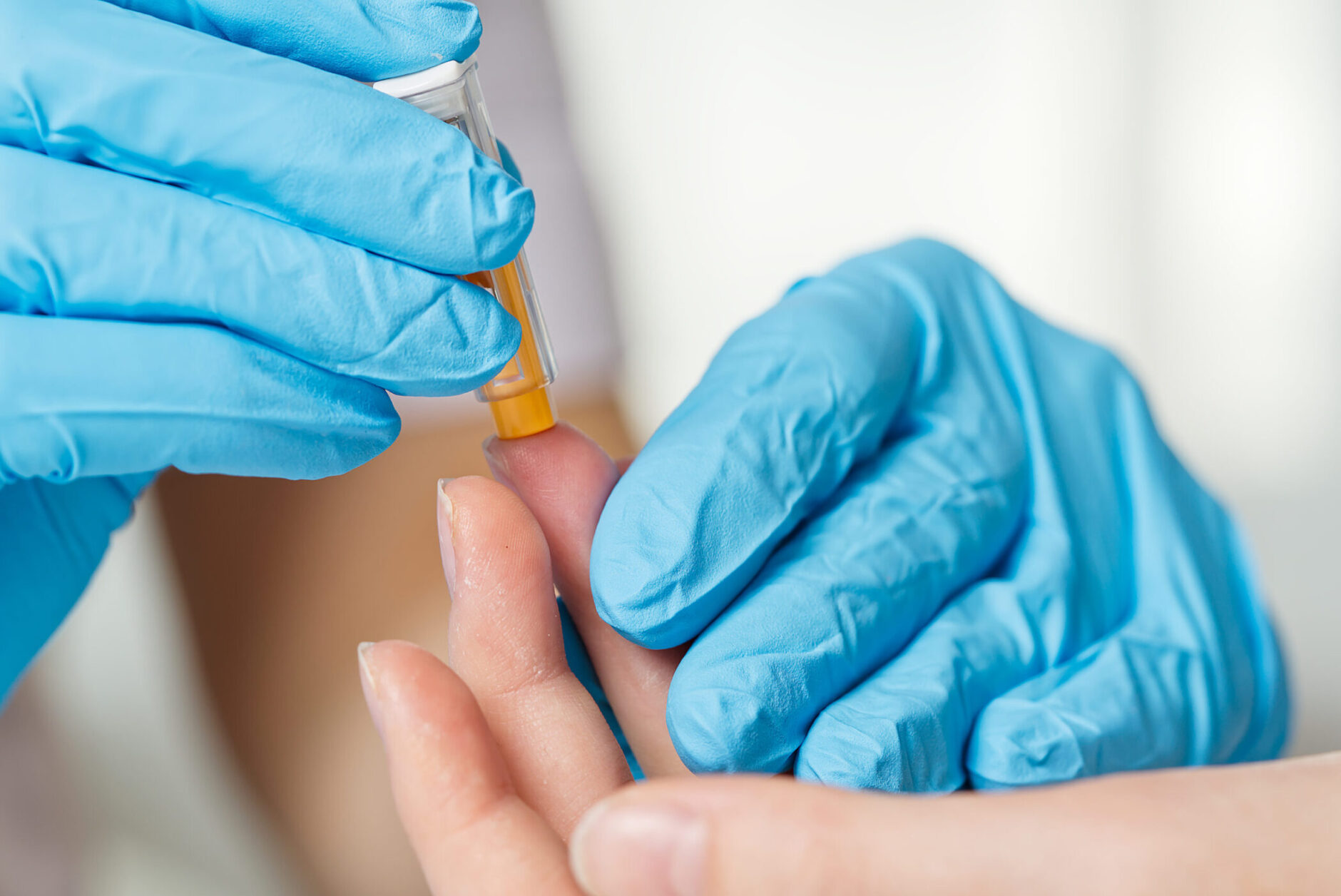 Doctor piercing patients finger with lancet in clinic closeup. Taking blood for close-up analysis, a clinical blood test